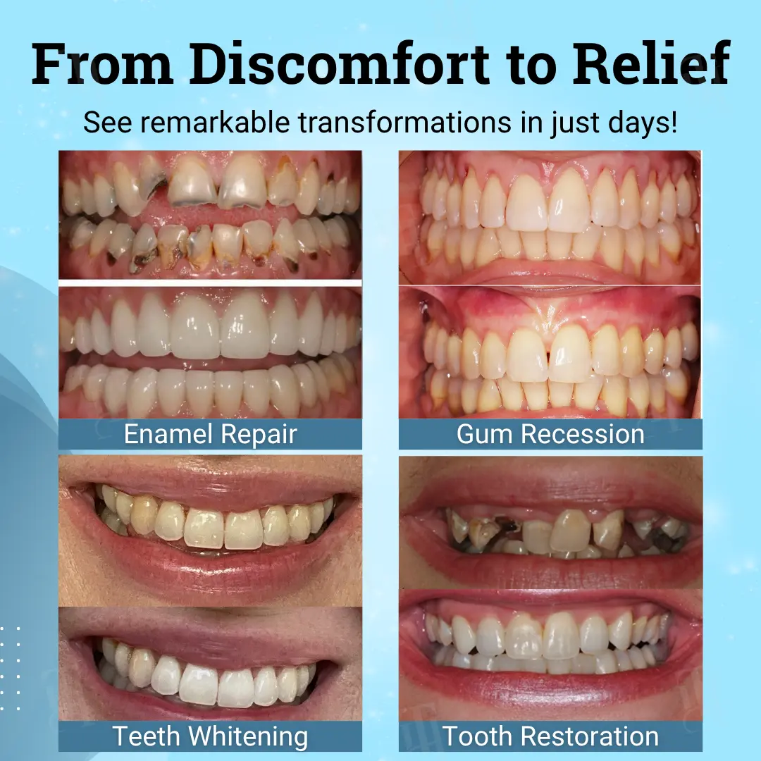 👨⚕️ Dentist's Choice : AEXZR® Non-Surgical Gum "Suture" Gel