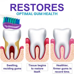 AEXZR® Apisphere Dental Repair Toothpaste.