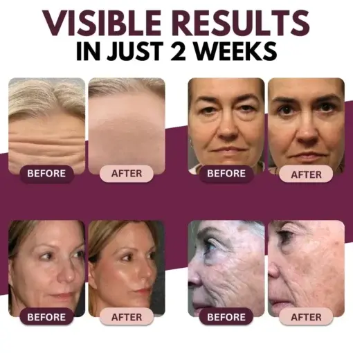 AEXZR® Calcium Multi Balm