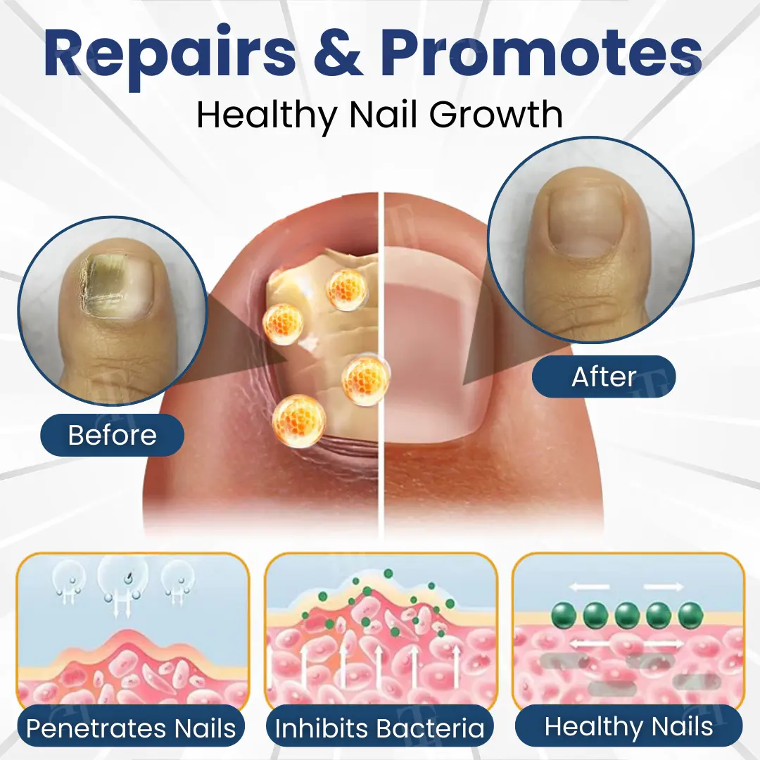 Valentine's Day Early Bird Special💕AEXZR® Bio-Active Deep Penetration System for Nail Fungus