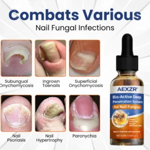 Valentine's Day Early Bird Special💕AEXZR® Bio-Active Deep Penetration System for Nail Fungus