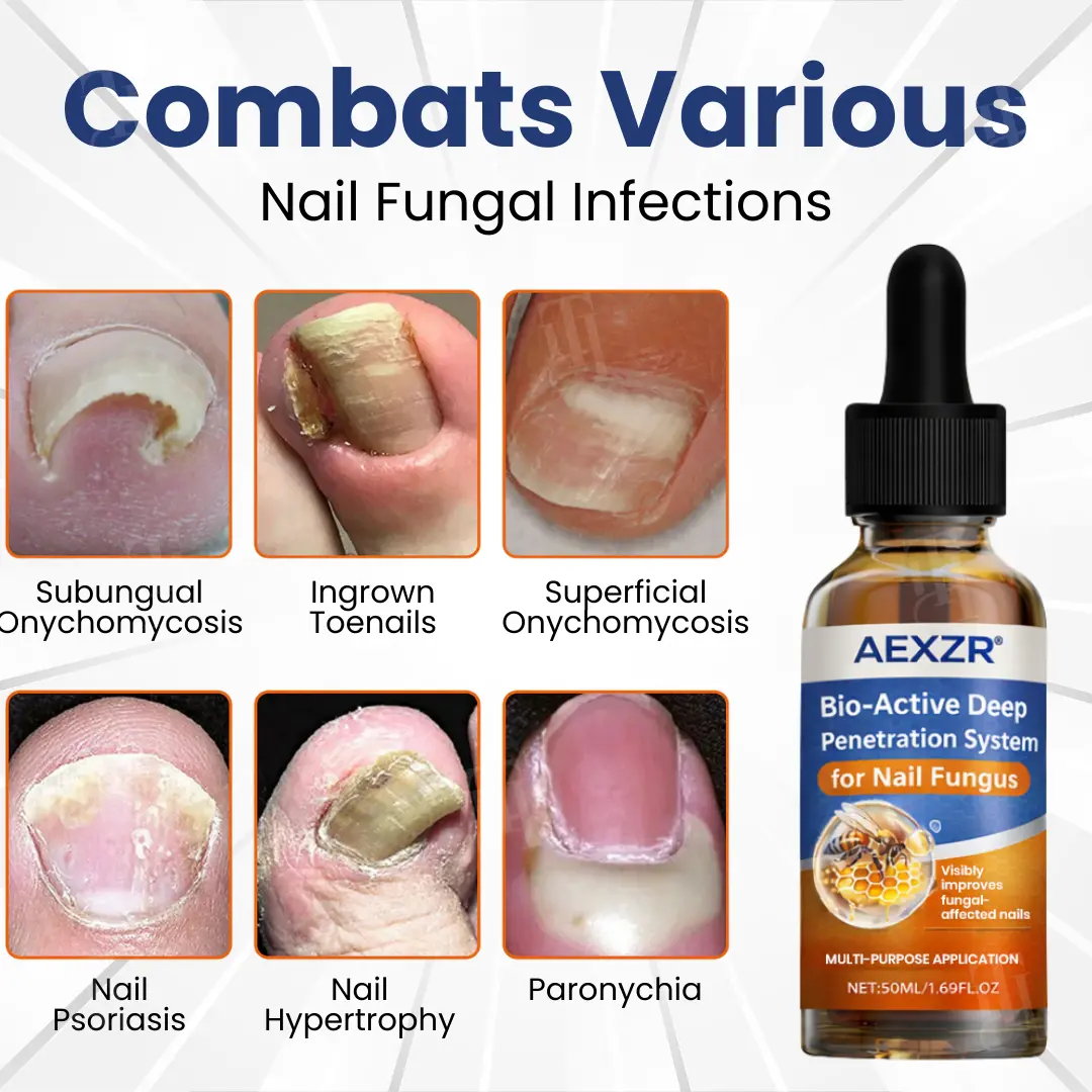 Valentine's Day Early Bird Special💕AEXZR® Bio-Active Deep Penetration System for Nail Fungus