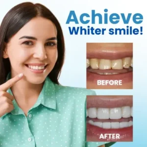 AEXZR® Anti-Plaque Oral Serum