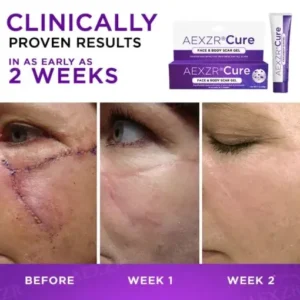 AEXZR® Cure Face & Body Scar Gel