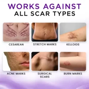 AEXZR® Cure Face & Body Scar Gel