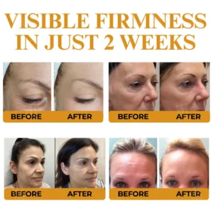 AEXZR® Letybo Bee Venom Wrinkle Removal Cream🐝 The Bee-Venom Peptide Revolution: Mimics Letybo’s Effects Without Needles for “Botox-Like” Smoothing.