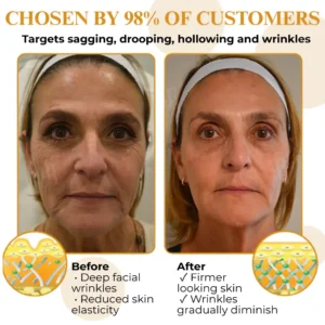 AEXZR® Letybo Bee Venom Wrinkle Removal Cream🐝 The Bee-Venom Peptide Revolution: Mimics Letybo’s Effects Without Needles for “Botox-Like” Smoothing.