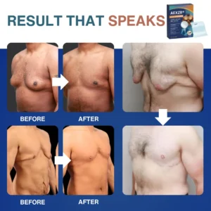 Official Store | 🩹 AEXZR® Nano-Microneedle Chest-Sculpt Bio-Patch (𝐉𝐮𝐬𝐭 𝐨𝐧𝐜𝐞 𝐚 𝐝𝐚𝐲, 𝐯𝐢𝐬𝐢𝐛𝐥𝐞 𝐜𝐡𝐚𝐧𝐠𝐞𝐬 𝐢𝐧 𝟕 𝑫𝐚𝐲𝐬） ✅ 𝐅𝐨𝐫 𝐆𝐲𝐧𝐞𝐜𝐨𝐦𝐚𝐬𝐭𝐢𝐚, 𝐄𝐱𝐜𝐞𝐬𝐬 𝐂𝐡𝐞𝐬𝐭 𝐅𝐚𝐭, 𝐒𝐚𝐠𝐠𝐢𝐧𝐠 𝐒𝐤𝐢𝐧, 𝙇𝙊𝙊𝙎𝗘 𝗦𝗞𝗜𝗡, 𝐚𝐧𝐝 𝐦𝐨𝐫𝐞 🌻