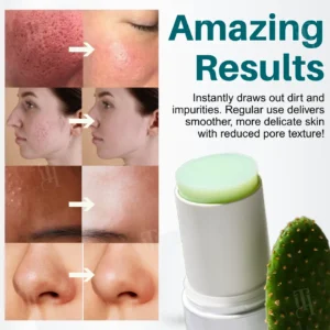 ✨ Instant Depuff & Glow! | ⏱️ Shrink Pores in Seconds! | AEXZR® CACTIGLOW Multi-Action Pore Refining Balm