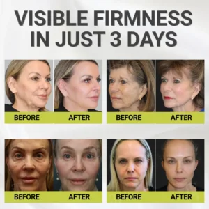 AEXZR® Botox & Vita-A Retinol Shot Wrinkle - Lift Tightening Cream ✨The Serum That Broke The Beauty Rules