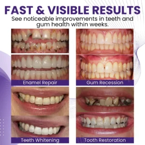 AEXZR® Smileagain Bee Venom Oral Treatment Powder